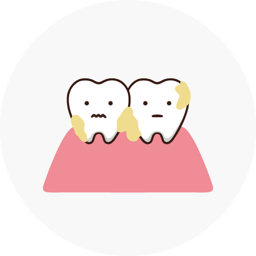 スケーリング・ルートプレーニング（歯石除去）